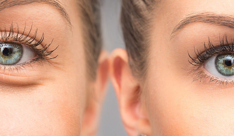 Sconfiggi borse e occhiaie: i segreti per prevenirle e ridurle