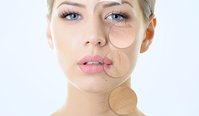 Quali sono i benefici del collagene? Più vigore e luminosità a pelle e capelli