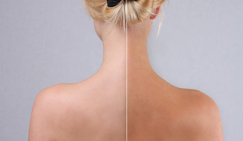 Autoabbronzante: come funziona e come usarlo per una pelle perfetta