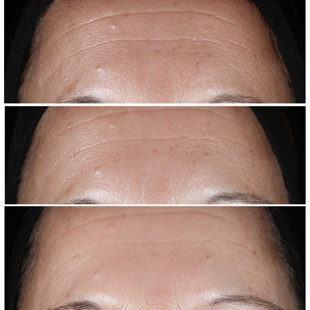 Clinique Smart Clinical Wrinkle Correcting Serum-3