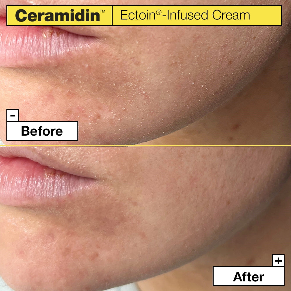 Dr.Jart+ Ceramidin Ectoin-Infused Cream-3