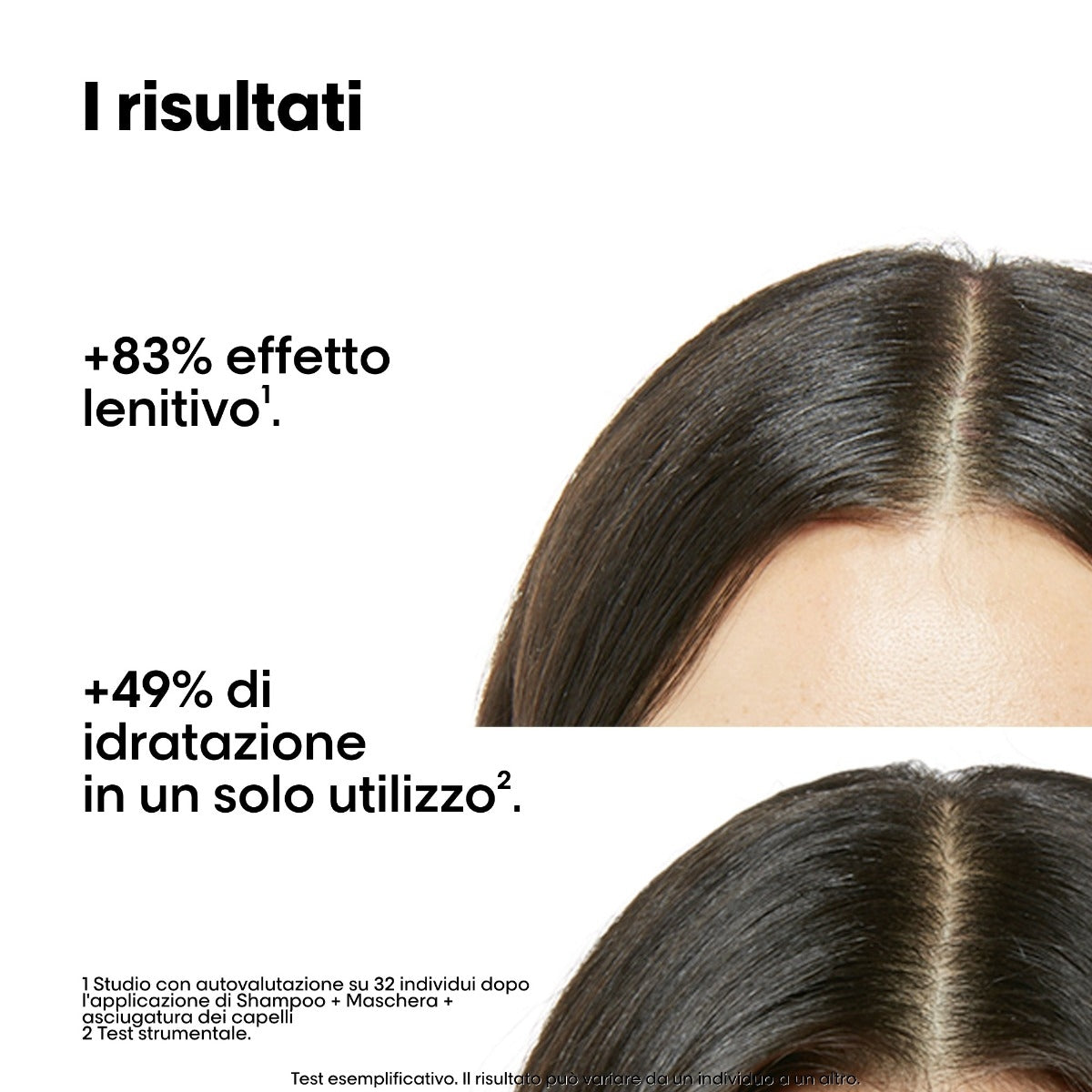 L'oreal Professionnel L'Oreal Professionel Glacial Utopia Limited Edition Scalp Advanced Duo-3