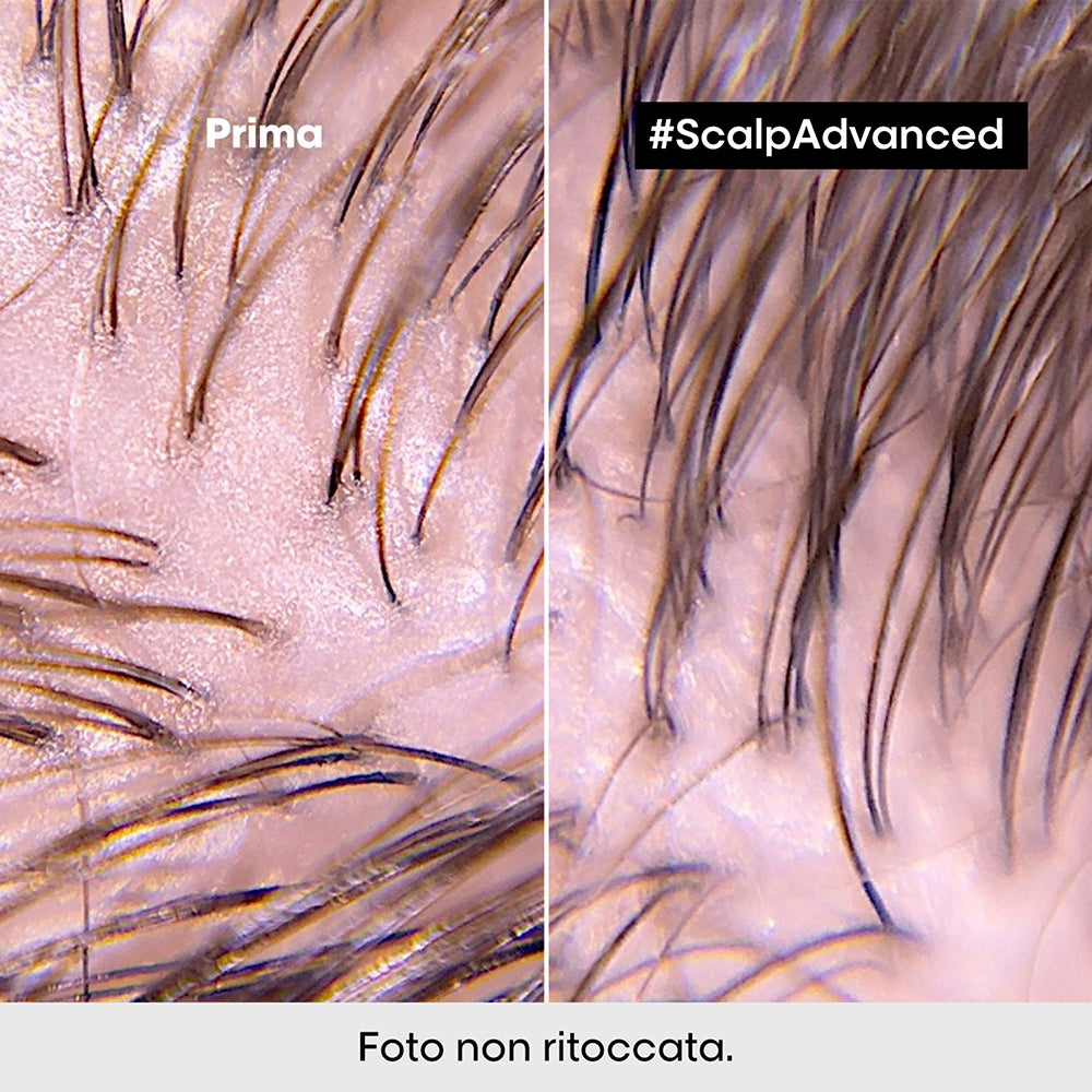 L'oreal Professionnel Scalp Advanced 2-in-1 Deep Purifier Clay Anti-Oiliness-4