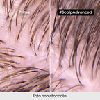 L'oreal Professionnel Scalp Advanced 2-in-1 Deep Purifier Clay Anti-Oiliness-4