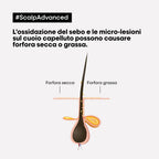 L'oreal Professionnel Scalp Advanced Anti-Dandruff-2