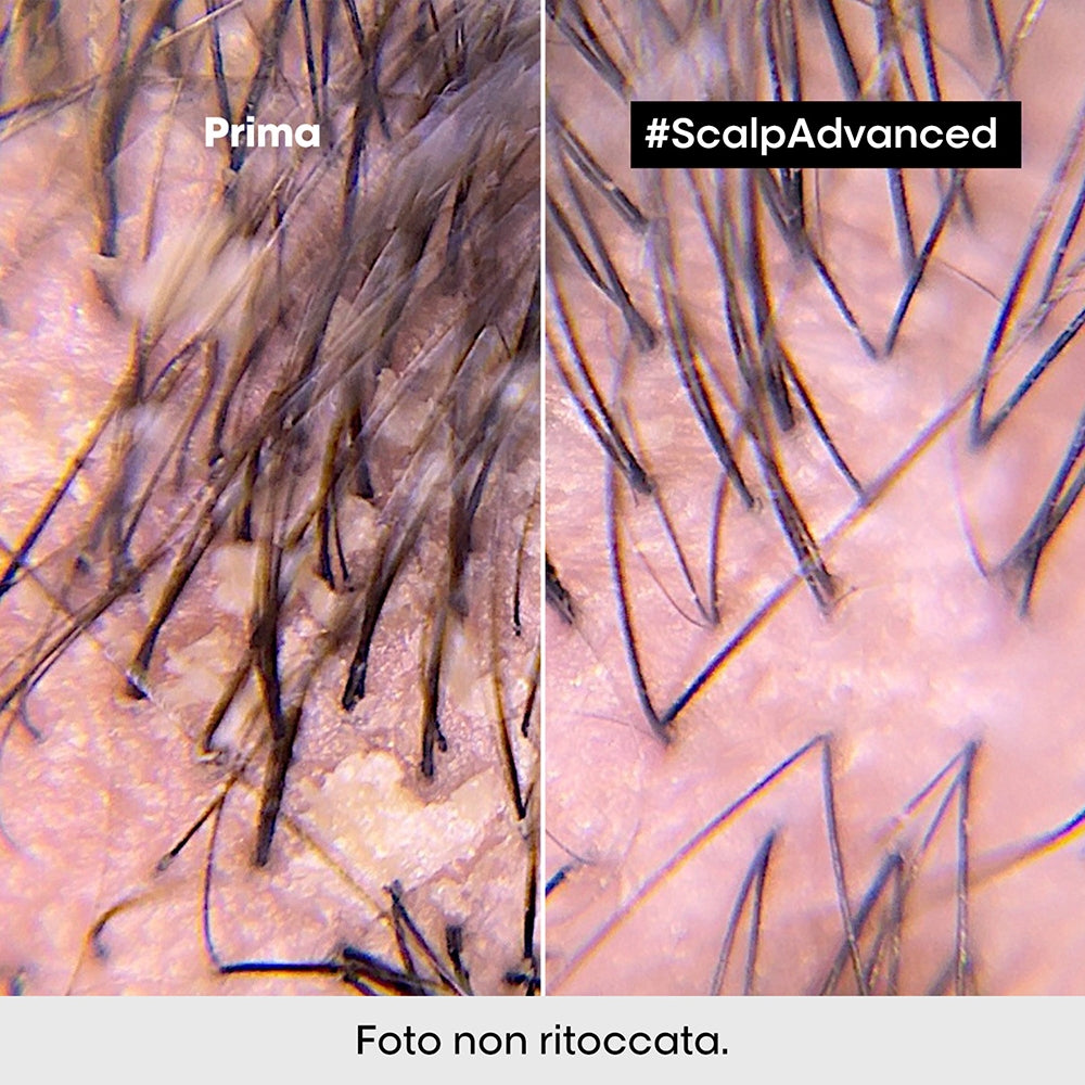 L'oreal Professionnel Scalp Advanced Anti-Dandruff-4