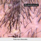 L'oreal Professionnel Scalp Advanced Anti-Dandruff-4