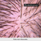 L'oreal Professionnel Scalp Advanced Anti-Discomfort-4