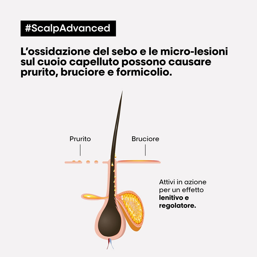 L'oreal Professionnel Scalp Advanced Trattamento Intense Soother Anti-Discomfort-2