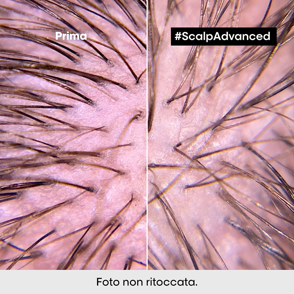 L'oreal Professionnel Scalp Advanced Trattamento Intense Soother Anti-Discomfort-4