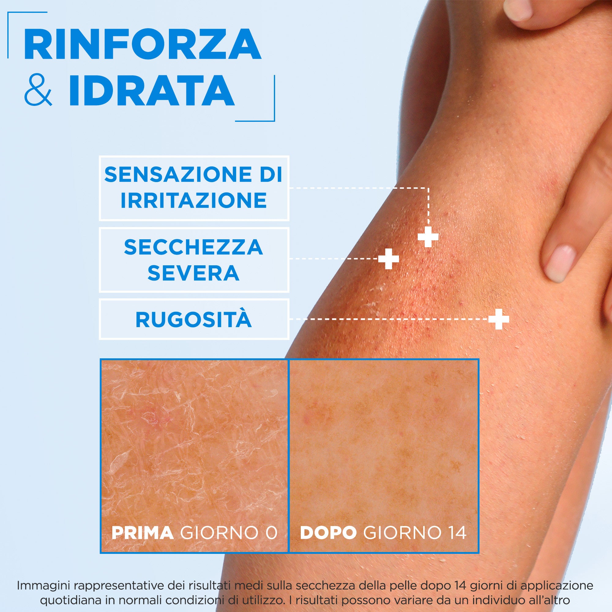 MIXA Ceramide Protect Crema Idratante Rinforzante -6