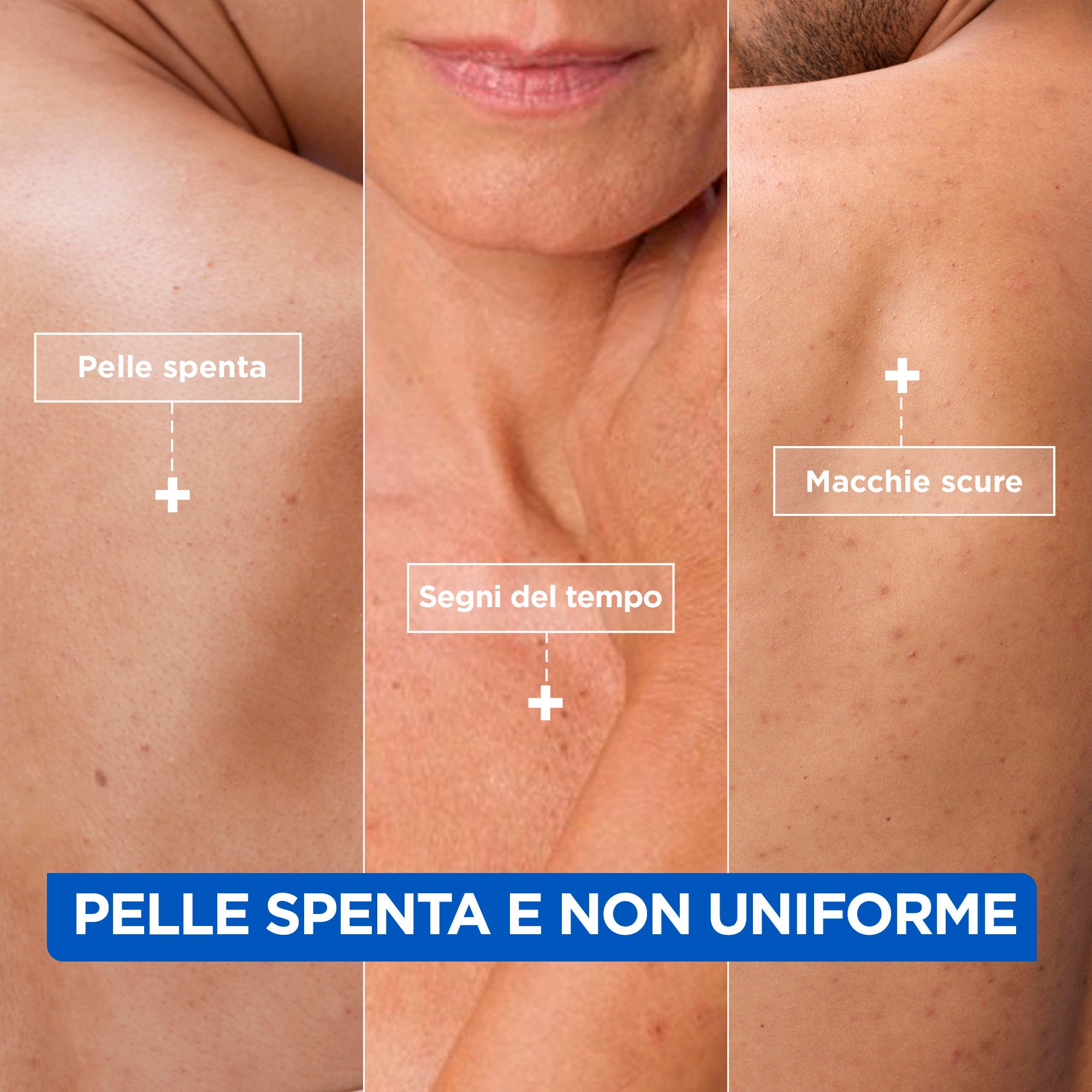 MIXA Niacinamide Bright Crema Idratante Anti-Macchie -2