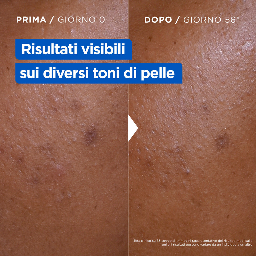 MIXA Niacinamide Bright Crema Idratante Anti-Macchie -3