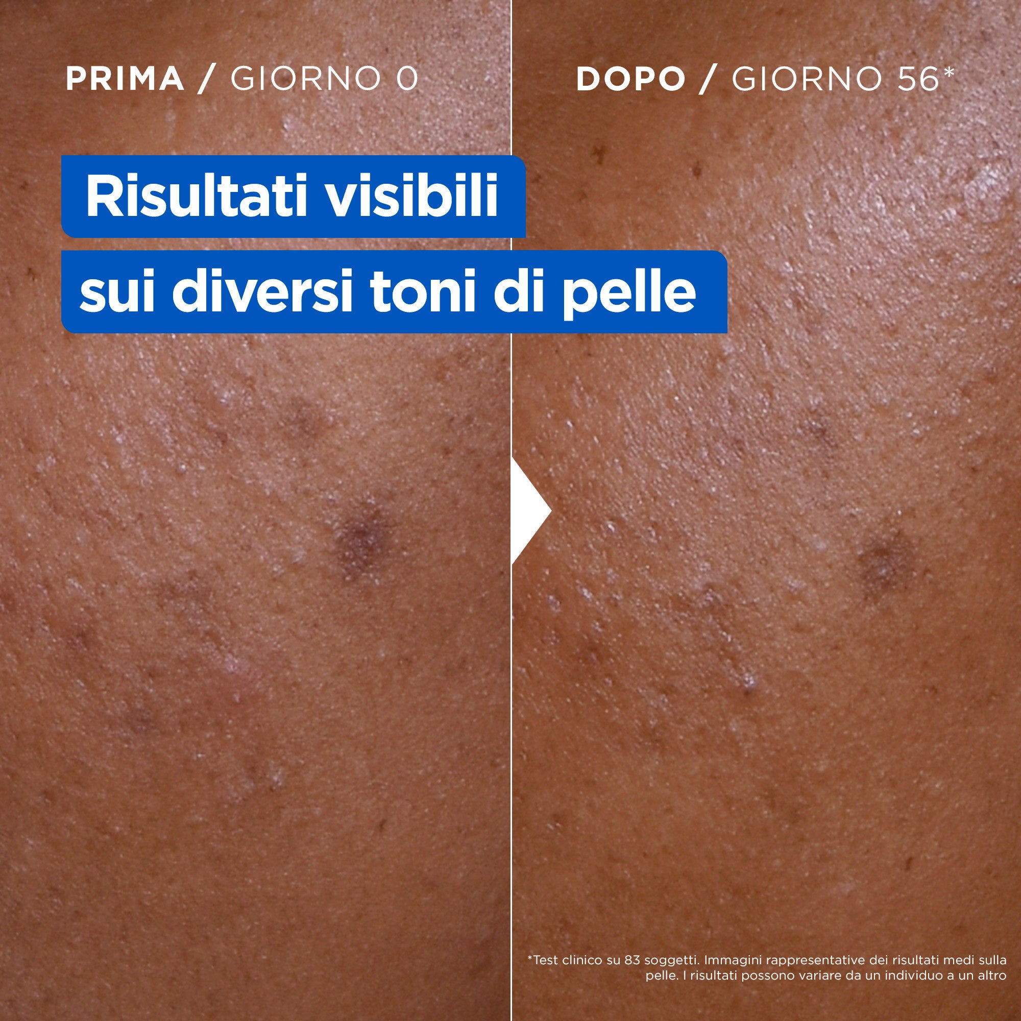 MIXA Niacinamide Bright Crema Idratante Anti-Macchie -3
