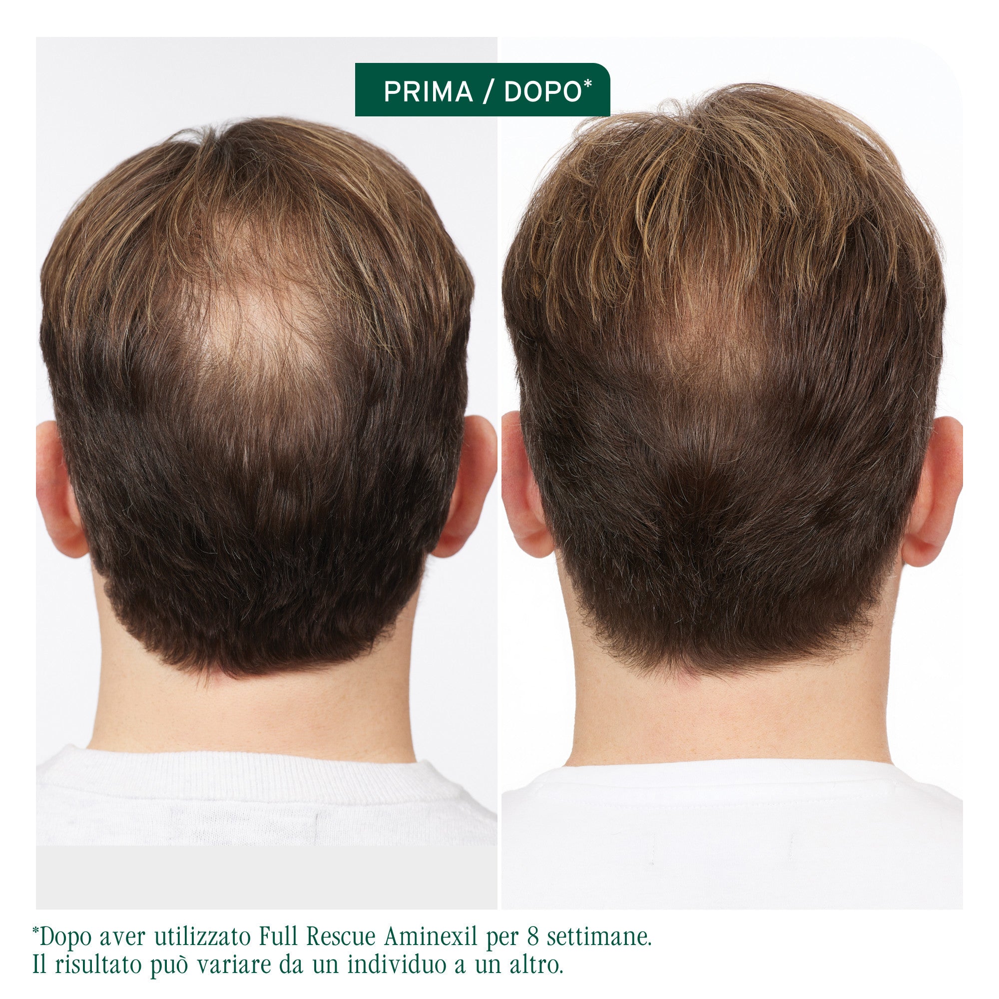 Matrix Biolage Full Rescue Amniexil Treatment-3
