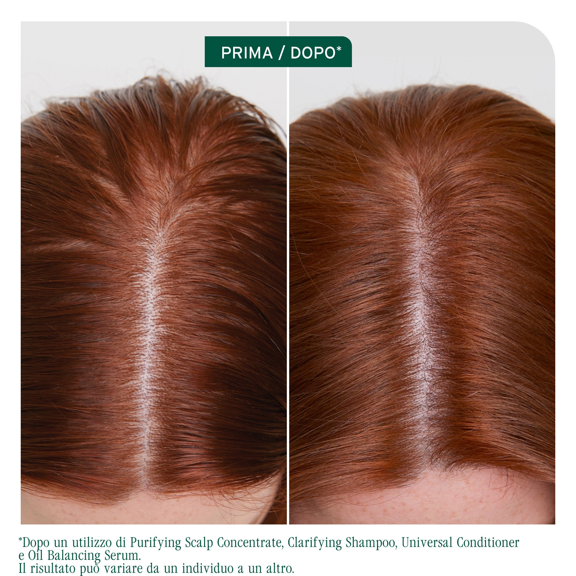 Matrix Biolage Scalp Sync Oil Balancing Serum-3