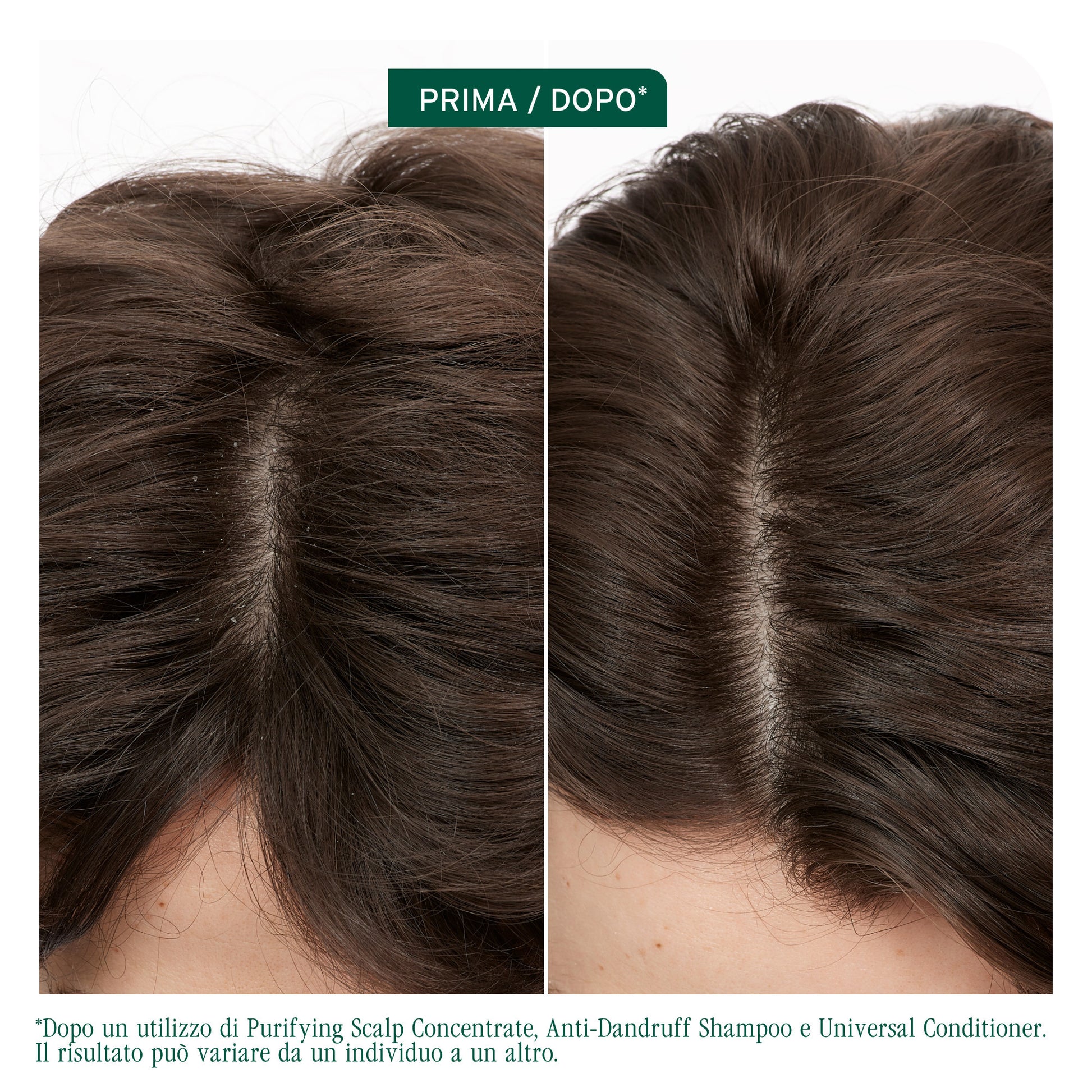 Matrix Biolage Scalp Sync Shampoo Anti-Dandruff-4