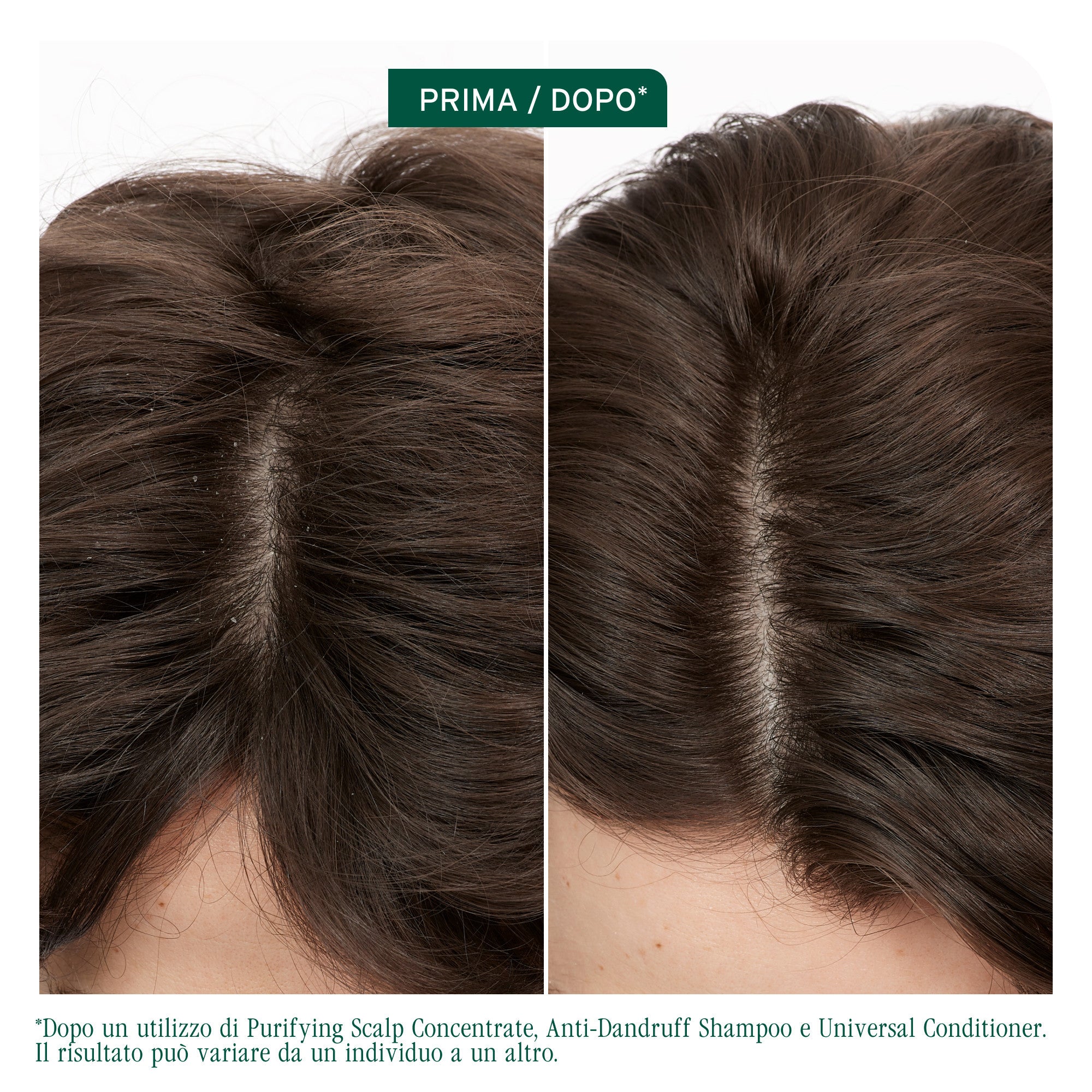 Matrix Biolage Scalp Sync Shampoo Anti-Dandruff-4