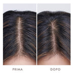 Moroccanoil Oily Scalp Treatment-4