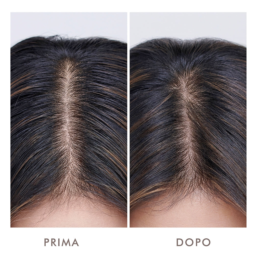 Moroccanoil Oily Scalp Treatment-4