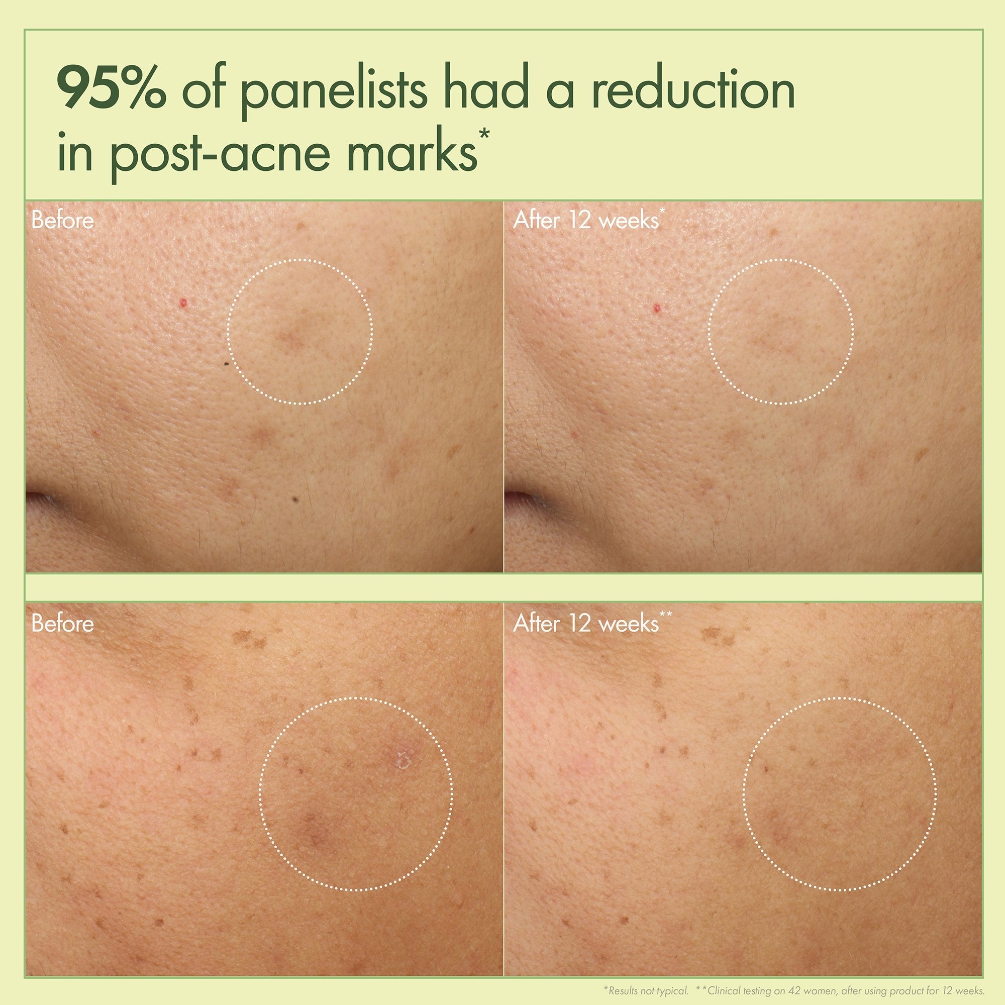 Origins Dr. Andrew Weil For Origins Mega-Mushroom Dark Spot Brightening Moisturizer-3