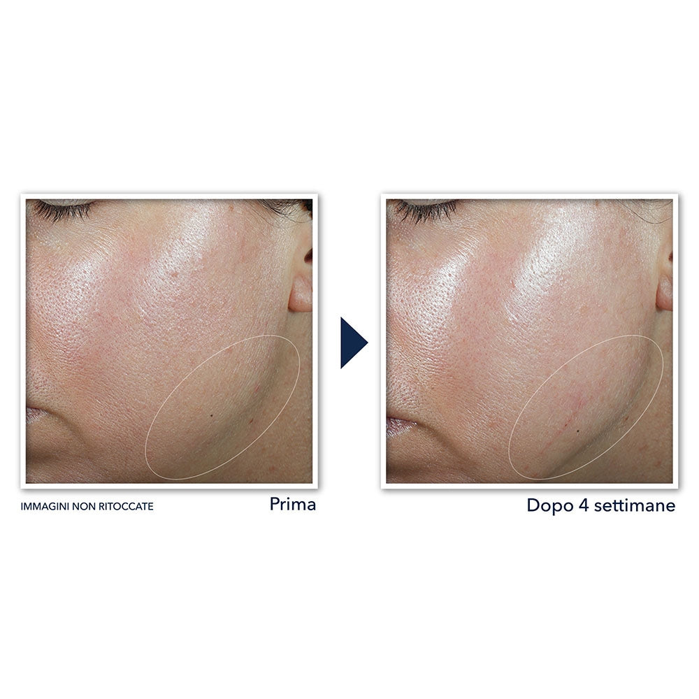 Roc Derm Correxion Crème Contour-5