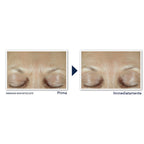 Roc Derm Correxion Sérum Combler + Traiter-4