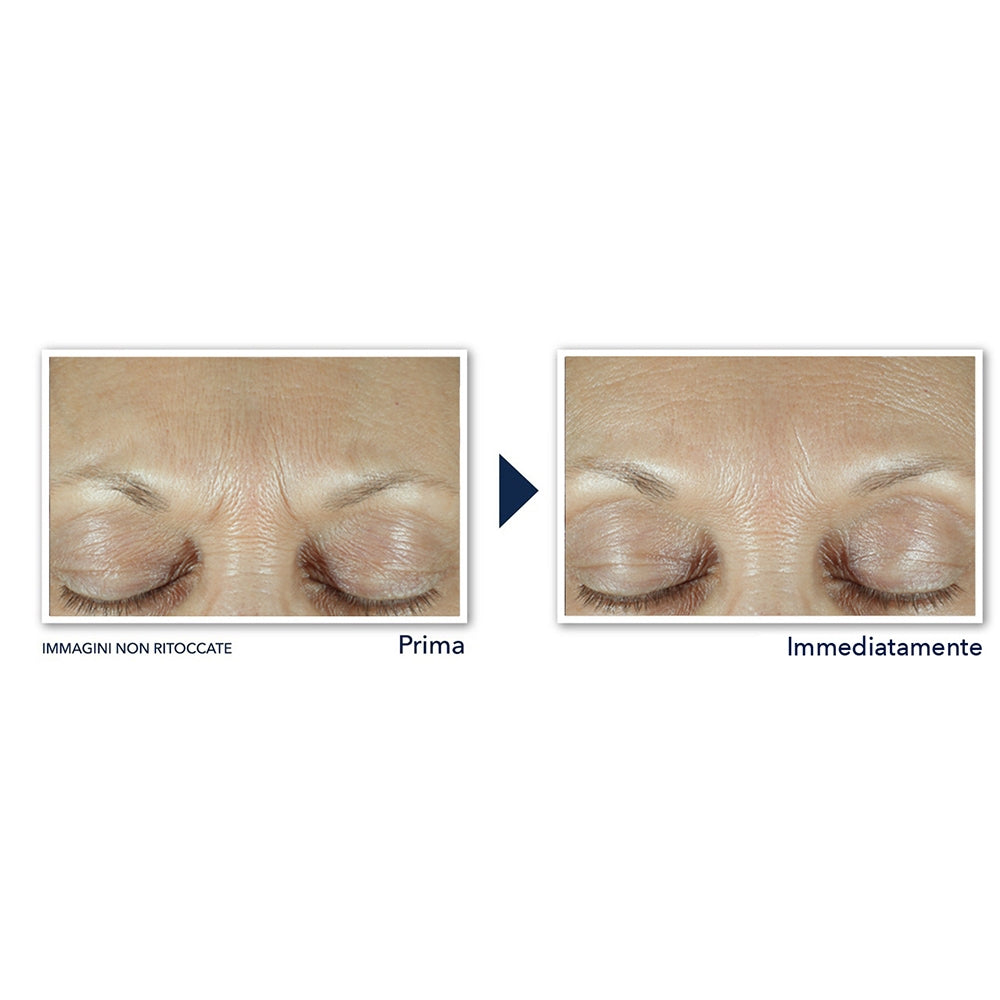 Roc Derm Correxion Sérum Combler + Traiter-4