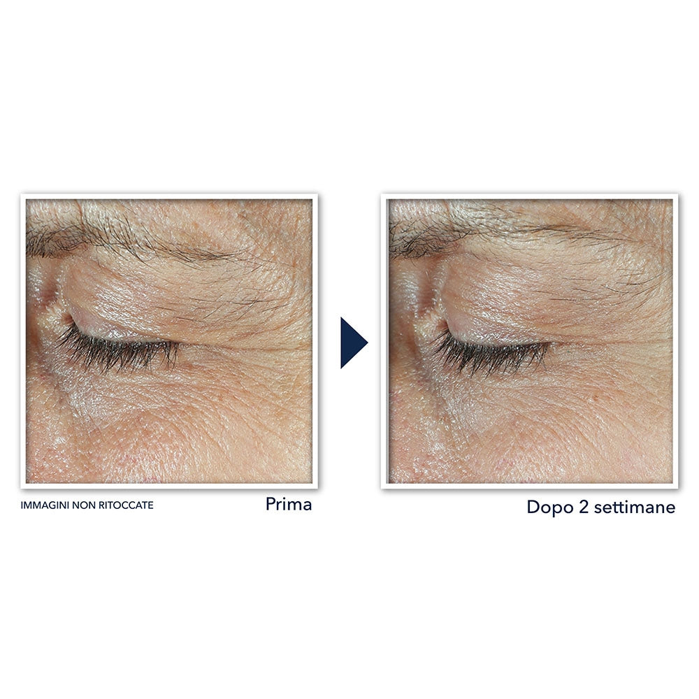 Roc Derm Correxion Soin Duo Contour Des Yeux-4