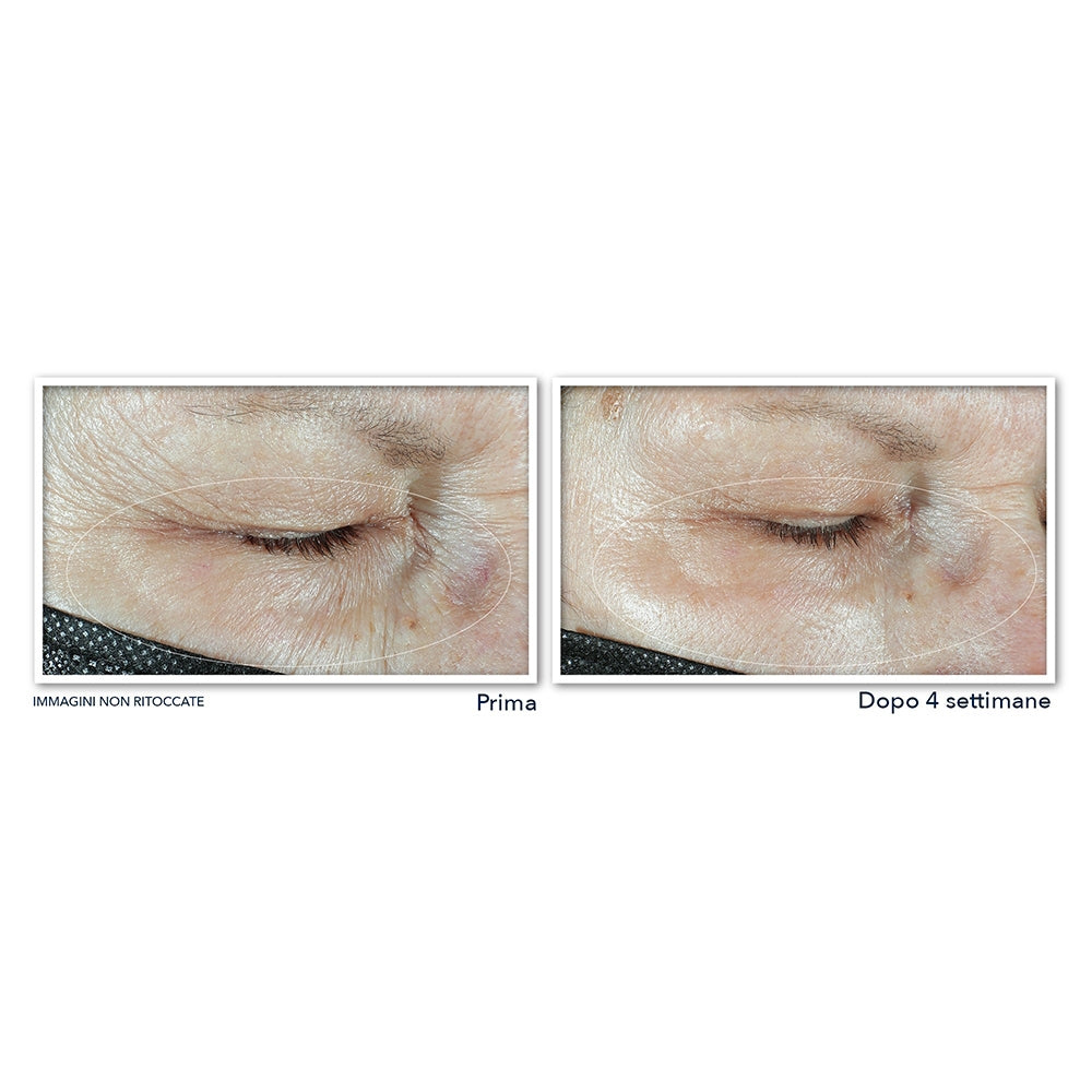 Roc Multi Correxion Hydrater + Repulper Crème Pour Les Yeux-4