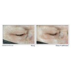 Roc Multi Correxion Hydrater + Repulper Crème Pour Les Yeux-4