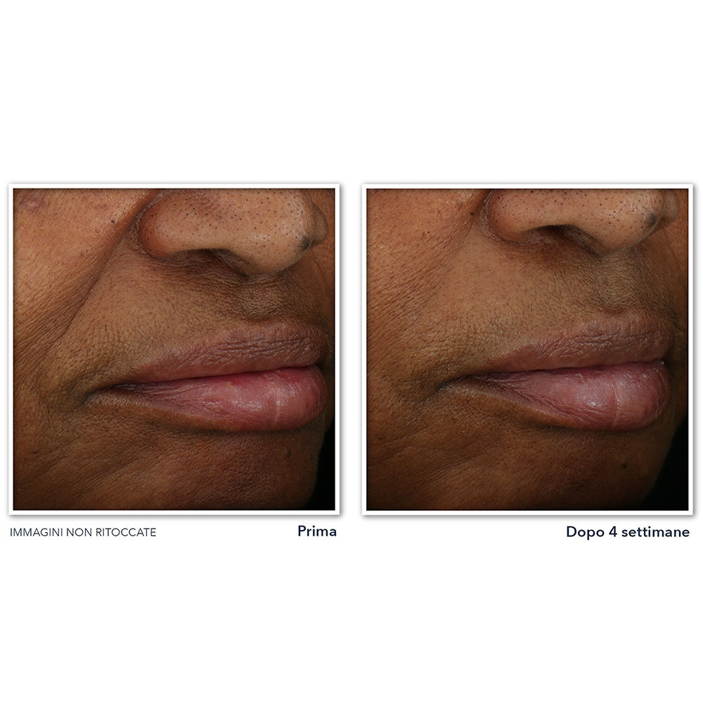 Roc Multi Correxion Renouveau + Éclat Crème Gel-4