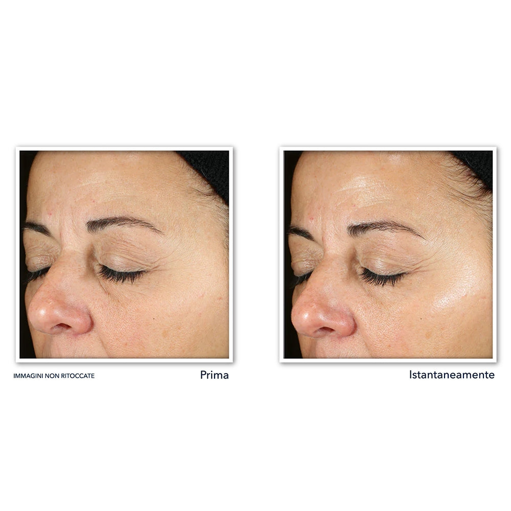 Roc Multi Correxion Renouveau + Éclat Sérum Quotidien-4