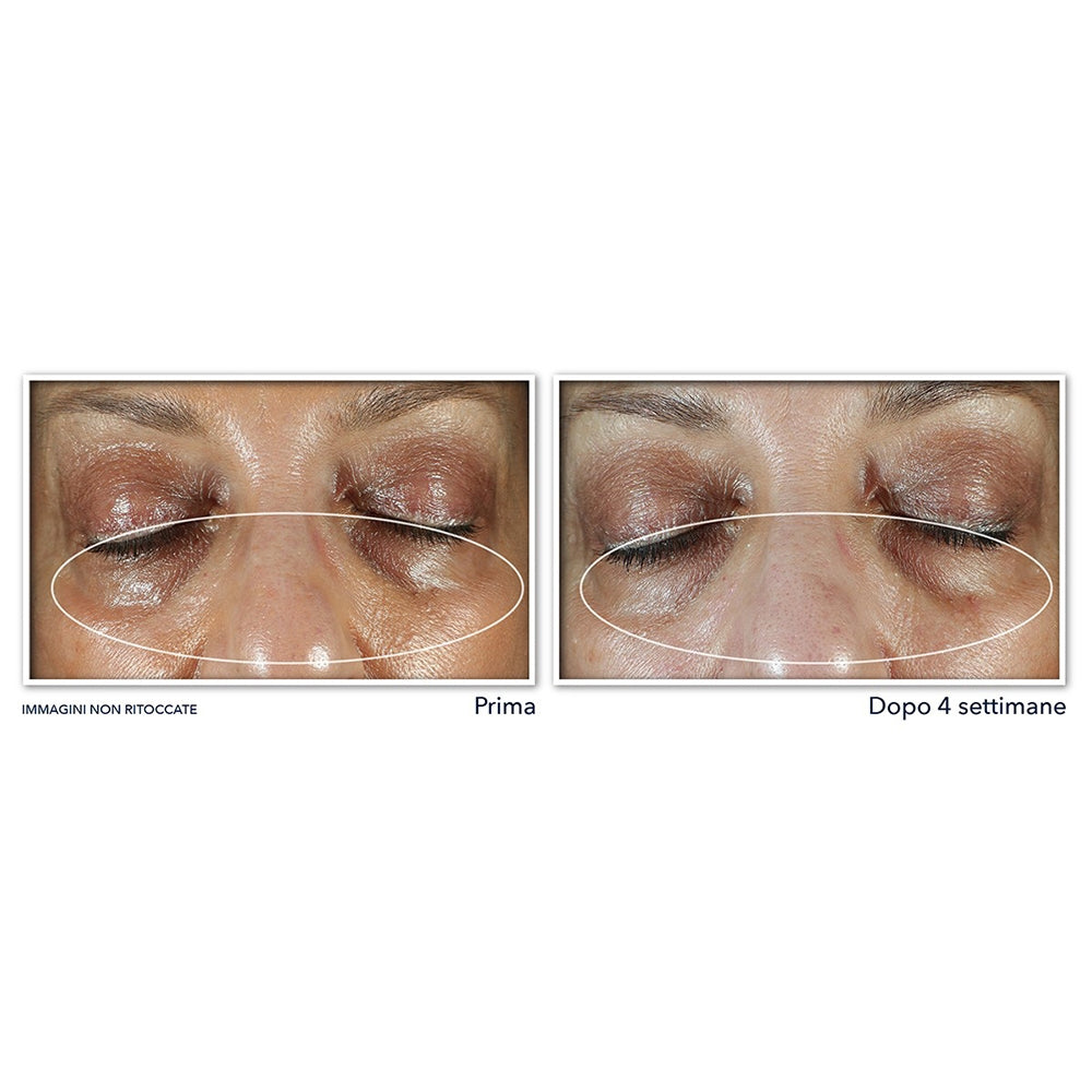 Roc Multi Correxion Unifier + Lifter Crème Pour Les Yeux-4