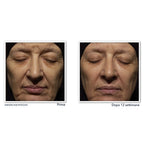 Roc Retinol Correxion Correction Rides Crème Nuit-4