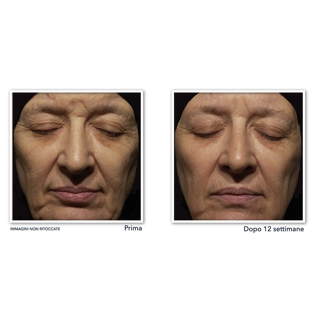 Roc Retinol Correxion Correction Rides Crème Nuit-4
