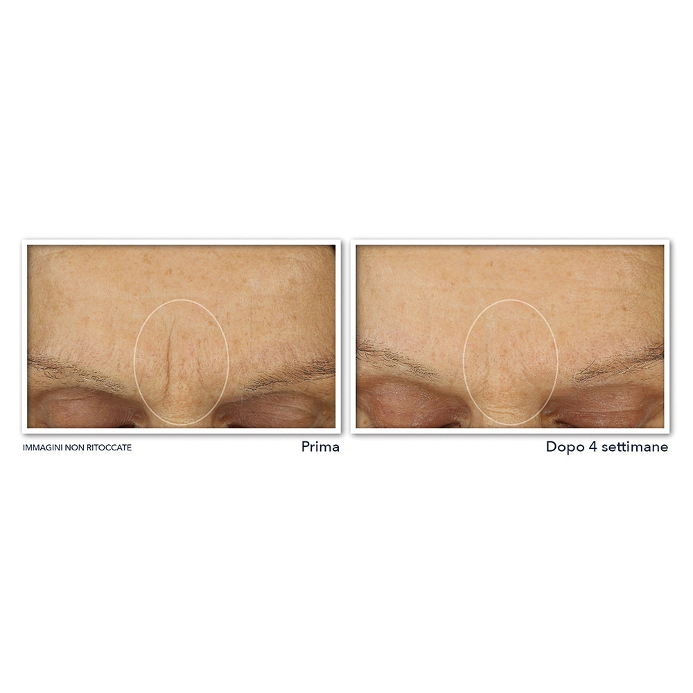 Roc Retinol Correxion Soin Lissant Crème Hydratation Maximale-4