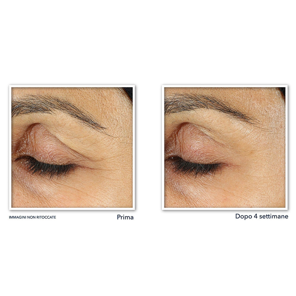 Roc Retinol Correxion Soin Lissant Crème Yeux-4